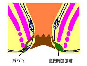 낤